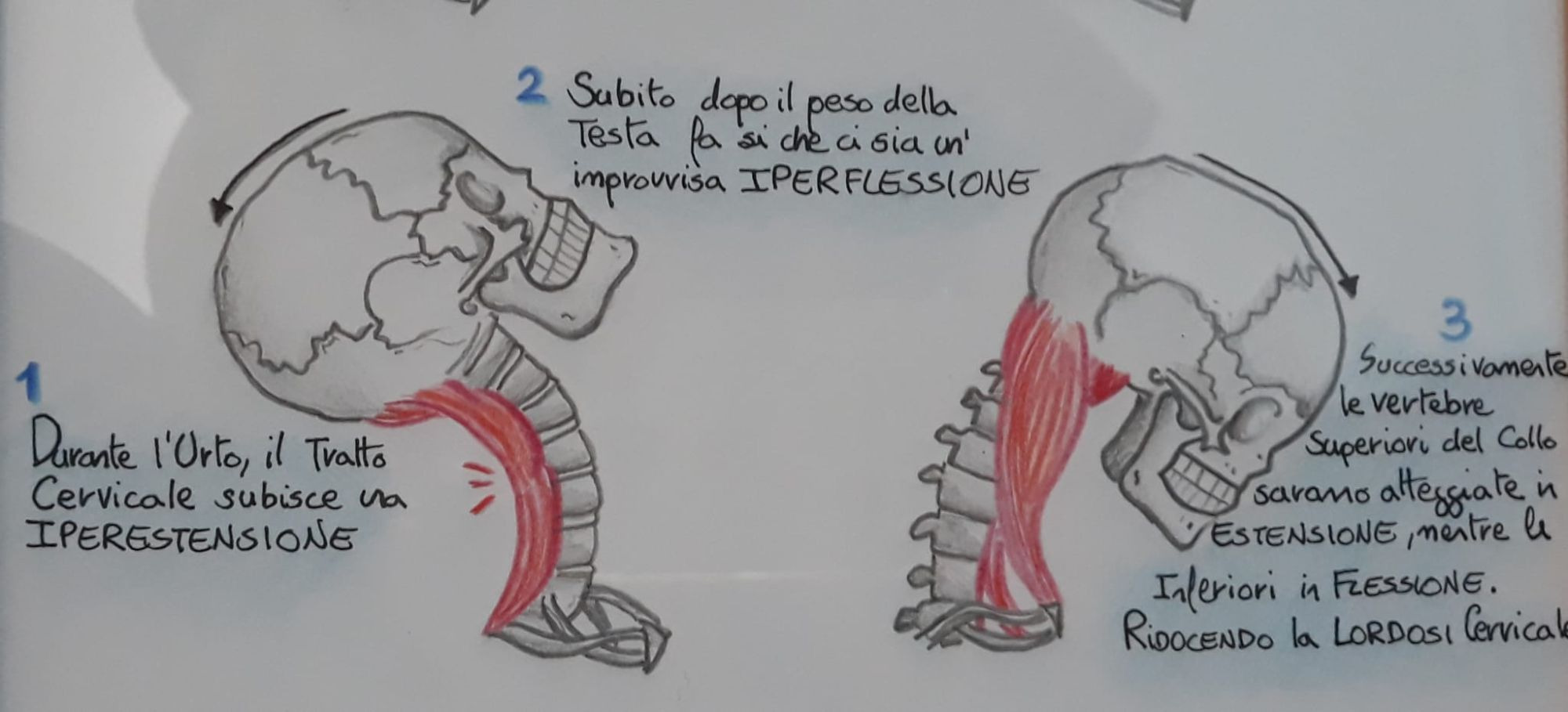 Osteopatia e Colpo di Frusta
